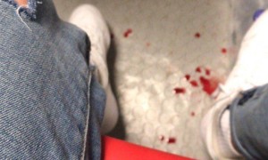 Фанати Динамо отримали ножові поранення під час сутичок у Греції. ФОТО. ВІДЕО